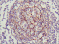 ab91190, at a 1/200 dilution, staining TrkC in paraffin embedded Human lymph node tissue by Immunohistochemistry. Detection was by DAB staining.