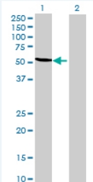 All lanes : Anti-TRMT2B antibody (ab69053) at 1/500 dilutionLane 1 : FLJ12687 transfected 293T cell lysateLane 2 : Non-transfected 293T cell lysateLysates/proteins at 25 µg per lane.SecondaryGoat anti-mouse IgG (H&L)-HRP conjugate at 1/2500 dilution