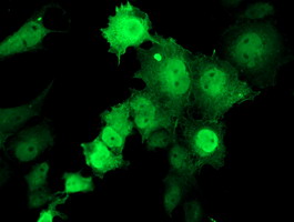 ab124034, at 1/100 dilution, staining Tropomodulin 1 in COS7 cells transiently transfected with pCMV6-ENTRY Tropomodulin 1 by Immunofluorescence.