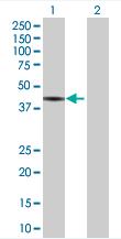 All lanes : Anti-Tropomodulin 2 antibody (ab67407) at 1/500 dilutionLane 1 : Tropomodulin 2 transfected 293T lysateLane 2 : Non transfected 293T lysateLysates/proteins at 25 µg per lane.SecondaryGoat Anti-Mouse IgG (H&L)-HRP Conjugate at 1/2500 dilutionObserved band size : 39.6 kDa (why is the actual band size different from the predicted?)