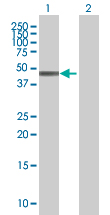 All lanes : Anti-Tropomodulin 4 antibody (ab67776) at 1/500 dilutionLane 1 : Tropomodulin 4 transfected 293T cell lysateLane 2 : Non transfected 293T cell lysateLysates/proteins at 25 µg per lane.SecondaryGoat Anti-Mouse IgG (H&L)-HRP conjugate at 1/2500 dilution
