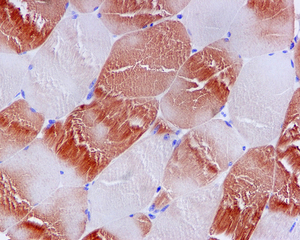Immunohistochemical analysis of paraffin-embedded Human skeletal muscle tissue using ab109505 at 1/500