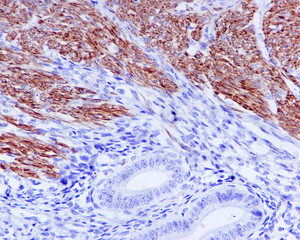 Immunohistochemical analysis of paraffin-embedded Human smooth muscle tissue using ab109505 at 1/500