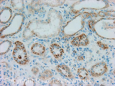 IHC image of SLIRP staining in Human normal kidney formalin fixed paraffin embedded tissue section, performed on a Leica BondTM system using the standard protocol F. The section was pre-treated using heat mediated antigen retrieval with sodium citrate buffer (pH6, epitope retrieval solution 1) for 20 mins. The section was then incubated with ab119687, 5µg/ml, for 15 mins at room temperature and detected using an HRP conjugated compact polymer system. DAB was used as the chromogen. The section was then counterstained with haematoxylin and mounted with DPX.For other IHC staining systems (automated and non-automated) customers should optimize variable parameters such as antigen retrieval conditions, primary antibody concentration and antibody incubation times.