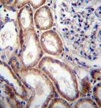 ab129345, at 1/10 dilution, staining Slit1 in formalin-fixed, paraffin-embedded Human kidney tissue by Immunohistochemistry, using a peroxidase conjugated secondary antibody and DAB staining.
