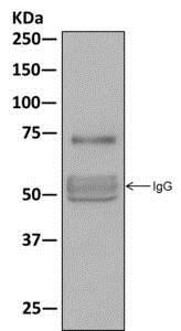 Western blot analysis on immunoprecipitation pellet from fetal skin lysate using ab177468 at 1/10 dilution.