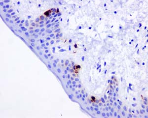 Immunohistochemical analysis of paraffin-embedded Human skin tissue labeling TRP1 with ab177468 at 1/50 diultion.