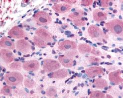 ab62053, at 20µg/ml, staining TRPA1 in Formalin/PFA Fixed Paraffin-Embedded Human DRG tissue cells by Immunohistochemistry.