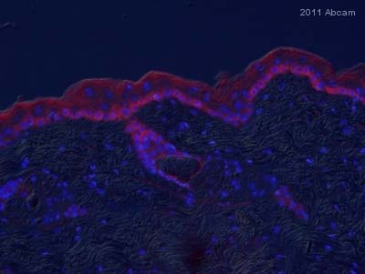 ab62053 staining TRPA1 in murine skin tissue by Immunohistochemistry (Frozen sections).Tissue was fixed in methanol, permeabilized with 0.4% Triton X-100, blocked using 10% serum for 30 minutes at 25°C and then incubated with ab62053 at a 1/100 dilution for 16 hours at 4°C. The secondary used was an Alexa-Fluor 594 conjugated goat anti-rabbit polyclonal used at a 1/500 dilution.See Abreview