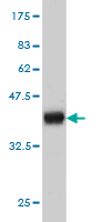 Western blot against tagged recombinant protein immunogen using ab56458 TRPA1 antibody at 1ug/ml.