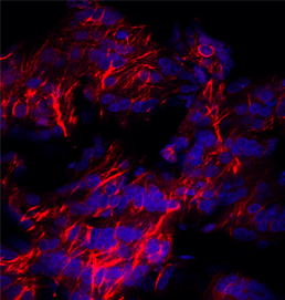 ab74819 (1/500) staining TRPC1 in rat brain tissue by Immunohistochemistry (frozen). DAPI counterstaining appears in blue