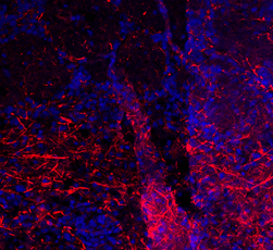 ab74819 (1/500) staining TRPC1 in rat brain tissue by Immunohistochemistry (frozen). DAPI counterstaining appears in blue