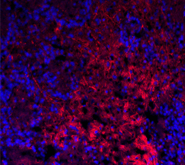 ab74819 (1/500) staining TRPC1 in rat brain tissue by Immunohistochemistry (frozen). DAPI counterstaining appears in blue