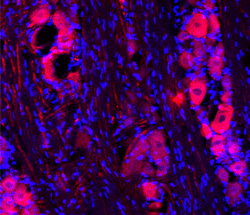 ab74819 (1/500) staining TRPC1 in rat trigeminal by Immunohistochemistry (frozen). DAPI counterstaining appears in blue