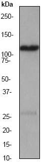 Anti-TRPC1 antibody [EP1417Y] (ab51255) at 1/10000 dilution + HepG2 cell lysate at 10 µgSecondaryGoat anti-Rabbit HRP labeled at 1/2000 dilution