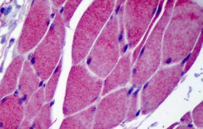 Immunohistochemical analysis of formalin-fixed, paraffin-embedded Human skeletal muscle tissue labeling TRPC3 with ab188802 at 5 µg/ml followed by biotinylated secondary antibody, alkaline phosphatase-streptavidin and chromogen.