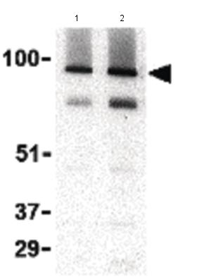 Lane 1 : Anti-TRPC3 antibody - C-terminal (ab188802) at 1 µg/mlLane 2 : Anti-TRPC3 antibody - C-terminal (ab188802) at 2 µg/mlLane 1 : Human brain tissue lysateLane 2 : Human brain tissue lysate