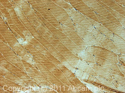 IHC image of ab63076 staining in mouse normal skeletal muscle formalin fixed paraffin embedded tissue section, performed on a Leica BondTM system using the standard protocol F. The section was pre-treated using heat mediated antigen retrieval with sodium citrate buffer (pH6, epitope retrieval solution 1) for 20 mins. The section was then incubated with ab63076, 1µg/ml, for 15 mins at room temperature and detected using an HRP conjugated compact polymer system. DAB was used as the chromogen. The section was then counterstained with haematoxylin and mounted with DPX.For other IHC staining systems (automated and non-automated) customers should optimize variable parameters such as antigen retrieval conditions, primary antibody concentration and antibody incubation times.