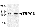 Lane 1 :  Anti-TRPC6 antibody (ab62461) at 0.5 µg/mlLane 2 :  Anti-TRPC6 antibody (ab62461) at 1 µg/mlLane 1 : K562 cell lysateLane 2 : K562 cell lysateLysates/proteins at 15 µg per lane.