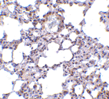 Immunohistochemistry of TRPC6 in paraffin embedded mouse lung tissue section with ab62461 at 10 µg/ml.