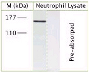 All lanes : Anti-TRPM7 antibody (ab72155) at 1/200 dilutionLane 1 : Human neutrophil lysateLane 2 : Immunising peptide