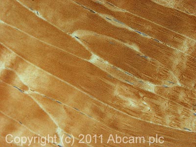 IHC image of ab72155 staining in mouse normal skeletal muscle formalin fixed paraffin embedded tissue section, performed on a Leica BondTM system using the standard protocol F. The section was pre-treated using heat mediated antigen retrieval with sodium citrate buffer (pH6, epitope retrieval solution 1) for 20 mins. The section was then incubated with ab72155, 5µg/ml, for 15 mins at room temperature and detected using an HRP conjugated compact polymer system. DAB was used as the chromogen. The section was then counterstained with haematoxylin and mounted with DPX.For other IHC staining systems (automated and non-automated) customers should optimize variable parameters such as antigen retrieval conditions, primary antibody concentration and antibody incubation times.