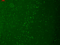ab85016 staining TRPM7 in human hippocampus tissue section by IHC-P. Bouin's fixed and paraffin-embedded tissue sections were used.