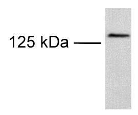 Anti-TRPM8 antibody (ab3243) at 1/750 dilution + TRPM8 transfected Cos7 cell lysate