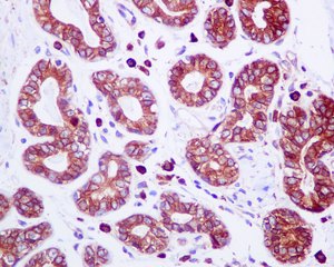 Immunohistochemical analysis of paraffin-embedded Human breast tissue labelling TRPV5 with ab137028 at 1/100 dilution.