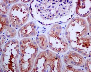 Immunohistochemical analysis of paraffin-embedded Human kidney tissue labelling TRPV5 with ab137028 at 1/100 dilution.