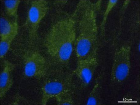 ab63084, staining TRPV6 (green) in equine articular chondrocytes, by Immunocytochemistry/ Immunofluorescence. Cells were fixed in ice-cold methanol for 10 min, washed and permeabilized with PBS-T and blocked with 10% BSA in PBS. The cells were then incubated with primary antibody overnight at 4°C. A DyLight®488-conjugated goat anti-rabbit polyclonal IgG (ab98462) was used as the secondary antibody. Nuclei were stained with DAPI (blue).