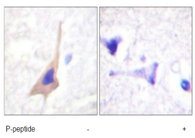 Immunohistochemistry analysis of paraffin-embedded human right temporal lobe using ab61068 at 1/50-1/100 dilution with or without immunising phosphopeptide.