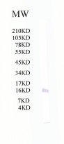 Anti-Tryptophan rich protein antibody (ab51550) at 1/500 dilution + WRB recombinant protein
