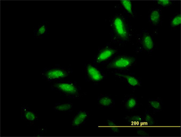 ab76915, at 10 µg/ml, staining TSC22 domain family, member 4 in Hela cells by Immunofluorescence