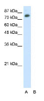 Anti-TSC22D2 antibody (ab50763) at 0.5 µg/ml + HepG2 Cell Lysate at 10 µgSecondaryHRP conjugated anti-Rabbit IgG at 50000
