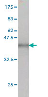Western blot against tagged recombinant protein immunogen using ab56562 TSC22D2 antibody at 1ug/ml.