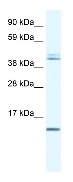 Anti-TSFM antibody (ab42464) at 0.5 µg/ml + Liver (Human) Cytoplasmic Lysate - fetal normal tissue (ab29876) at 10 µg/mlSecondaryHRP conjugated anti-Rabbit IgG at 1/50000 dilution