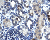 Analysis of TSFM expression on paraffin embedded human kidney tissue, using ab42464 at a dilution of 8µg/ml (positively labelled epithelial cells of renal tubule).