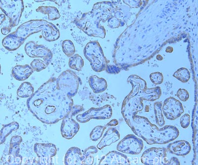 IHC image of ab30871 staining in human placenta formalin fixed paraffin embedded tissue section, performed on a Leica BondTM system using the standard protocol F. The section was pre-treated using heat mediated antigen retrieval with sodium citrate buffer (pH6, epitope retrieval solution 1) for 20 mins. The section was then incubated with ab30871, 5µg/ml, for 15 mins at room temperature and detected using an HRP conjugated compact polymer system. DAB was used as the chromogen. The section was then counterstained with haematoxylin and mounted with DPX. For other IHC staining systems (automated and non-automated) customers should optimize variable parameters such as antigen retrieval conditions, primary antibody concentration and antibody incubation times.