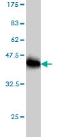 Western blot against tagged recombinant protein immunogen using ab58180 TSGA2 antibody at 1ug/ml.