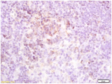 Immunohistochemical analysis of formalin-fixed and paraffin embedded Mouse spleen tissue labeling TSH Receptor using ab202960 at 1/200 dilution, followed by conjugation to the secondary antibody and DAB staining.