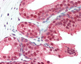 ab115690 at 5ug/ml staining SLITRK4 in Human prostate tissue by immunohistochemistry (FFPE). Following primary incubation slides were incubated with biotinylated goat anti-rabbit IgG secondary antibody, alkaline phosphatase-streptavidin and chromogen.