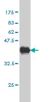 Western blot against tagged recombinant protein immunogen using ab58379 TSSC3 antibody at 1ug/ml. 