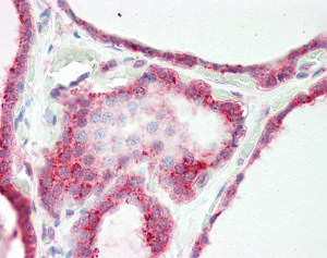 ab115690 at 5ug/ml staining SLITRK4 in Human thyroid tissue by immunohistochemistry (FFPE). Following primary incubation slides were incubated with biotinylated goat anti-rabbit IgG secondary antibody, alkaline phosphatase-streptavidin and chromogen.