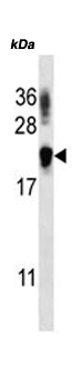Anti-TTC33 antibody (ab172933) at 1/500 dilution + NCI-H292 cell line lysate at 35 µgSecondaryHRP anti-rabbit at 1/10000 dilutiondeveloped using the ECL technique