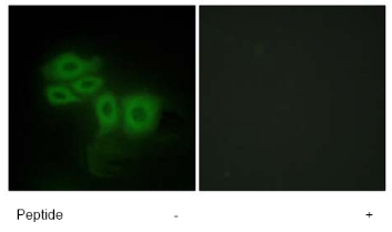 Immunofluorescence analysis of HepG2 cells, using ab65113 antibody at 1/500-1/1000 dilution