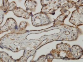 SLK antibody (ab56749) used in immunohistochemistry at 3ug/ml on formalin fixed and paraffin embedded human placenta.
