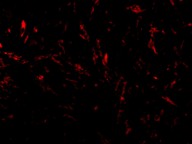Immunofluorescence of TTC5 in Mouse Brain cells using ab36855 at 20 ug/ml.
