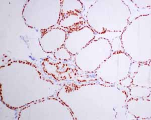 Immunohistochemical analysis using ab137061 showing positive staining in Thyroid gland tissue.