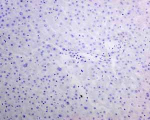 Immunohistochemical analysis using ab137061 showing negative staining in Normal liver tissue.